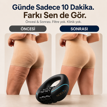 Noelia Selülit Masaj Aleti | Sıkılaştırıcı Vücut Şekillendirici Masaj Cihazı